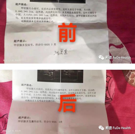 图片[4]-《疏经通脉法》慢性病和疑难杂症的克星，也是一个唤醒你自愈能力的“奇技”