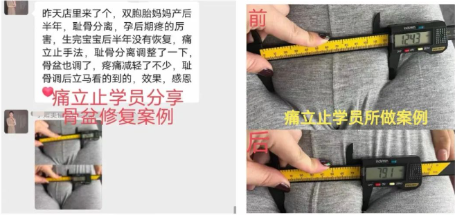 图片[4]-【非遗传承・无痛正骨】痛立止理骨术课程简章：零基础也能学会的柔性正骨技术