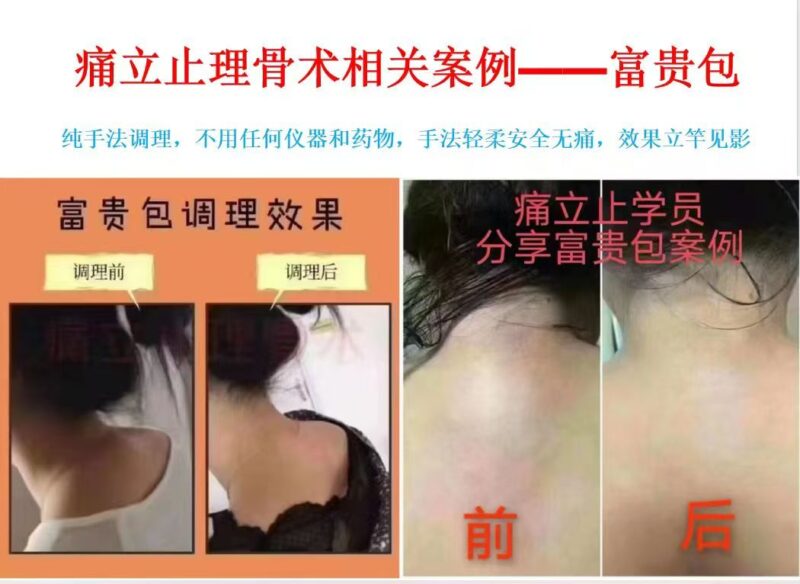 图片[6]-【非遗传承・无痛正骨】痛立止理骨术课程简章：零基础也能学会的柔性正骨技术