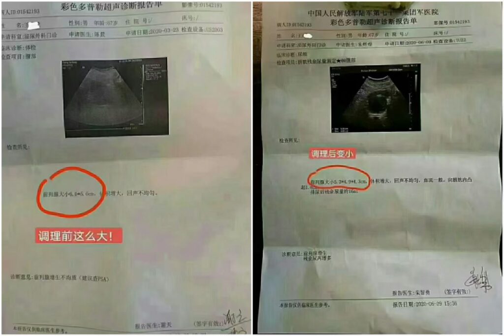 图片[22]-《疏经通脉法》慢性病和疑难杂症的克星，也是一个唤醒你自愈能力的“奇技”