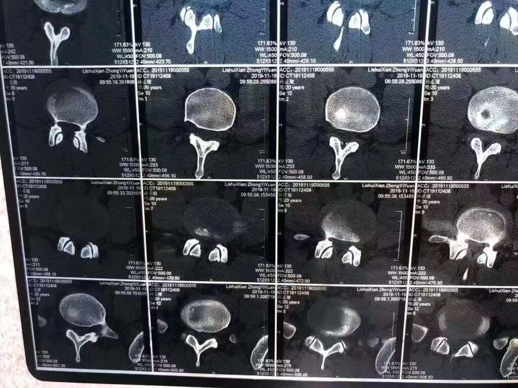 图片[1]-影像检查≠精准诊断：论摸骨诊断在《痛立止理骨术》中的核心价值