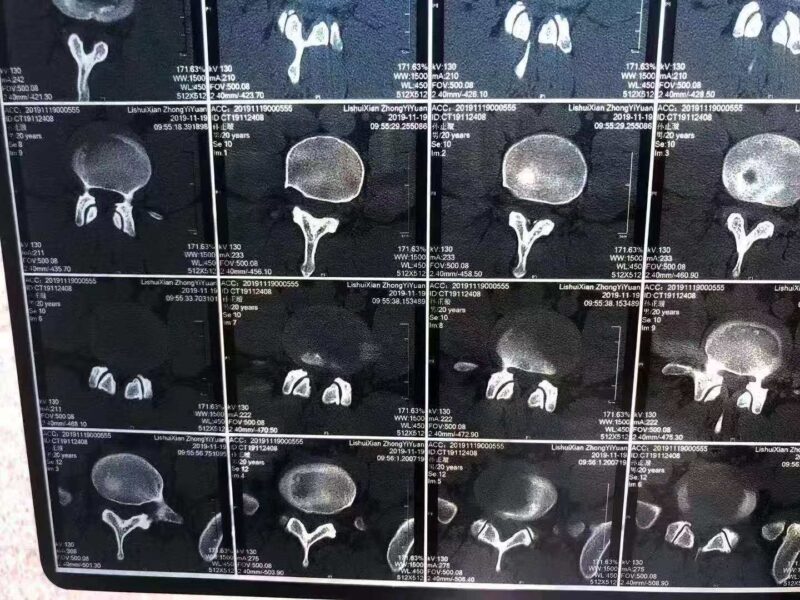影像检查≠精准诊断：论摸骨诊断在《痛立止理骨术》中的核心价值