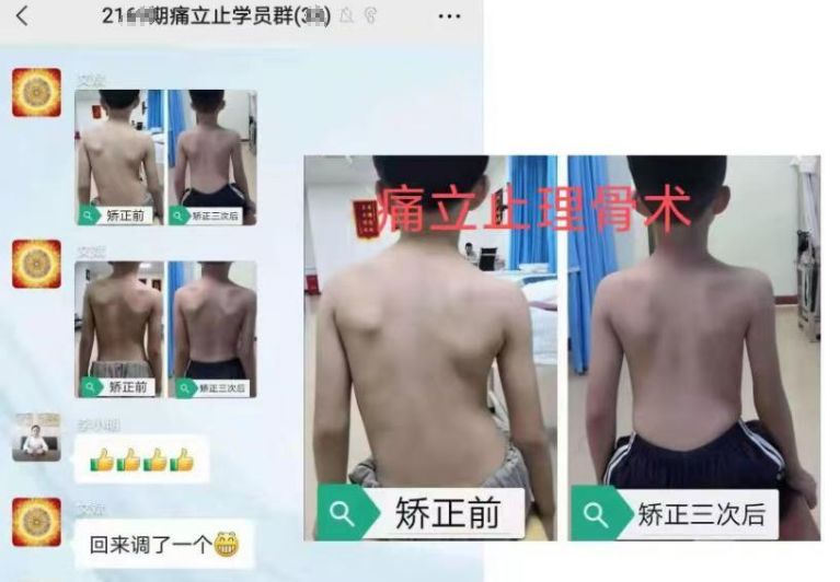【学员案例】青少年脊柱侧弯有救了！痛立止学员首期学成即创调理奇迹