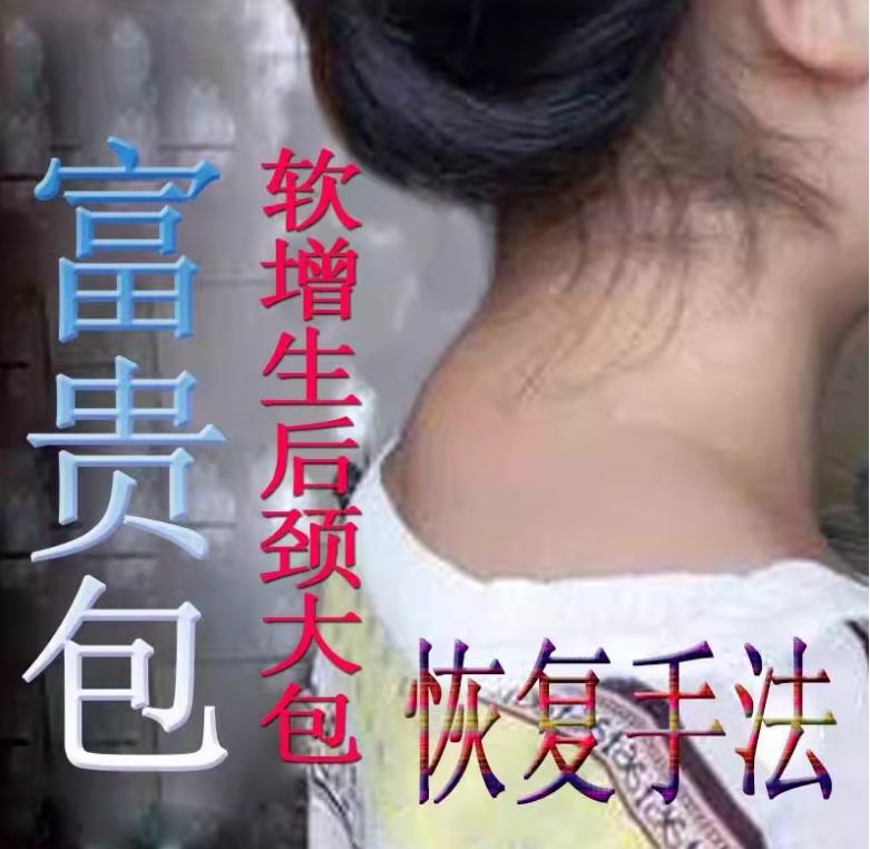 颈后大包(富贵包)处理手法视频教程