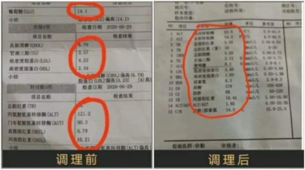 图片[3]-《疏经通脉法》慢性病和疑难杂症的克星，也是一个唤醒你自愈能力的“奇技”