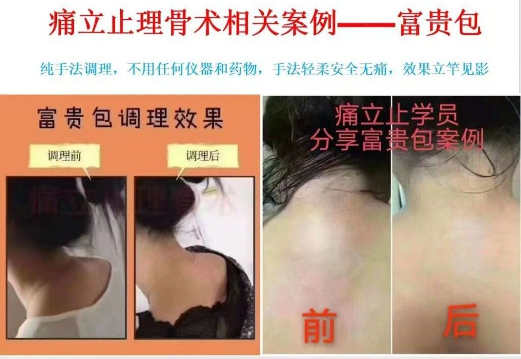 图片[8]-痛立止理骨术｜从摸骨到复位，零基础轻松掌握柔性正骨核心技术