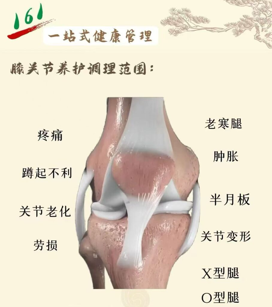 图片[6]-孵德集团《161膝关节养护》品牌加盟项目介绍