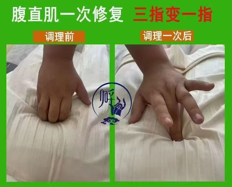 图片[5]-痛立止理骨术｜从摸骨到复位，零基础轻松掌握柔性正骨核心技术