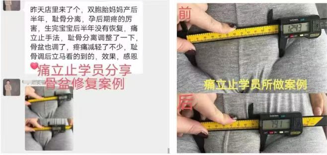 图片[6]-痛立止理骨术｜从摸骨到复位，零基础轻松掌握柔性正骨核心技术