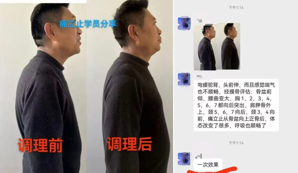 图片[13]-痛立止理骨术｜从摸骨到复位，零基础轻松掌握柔性正骨核心技术