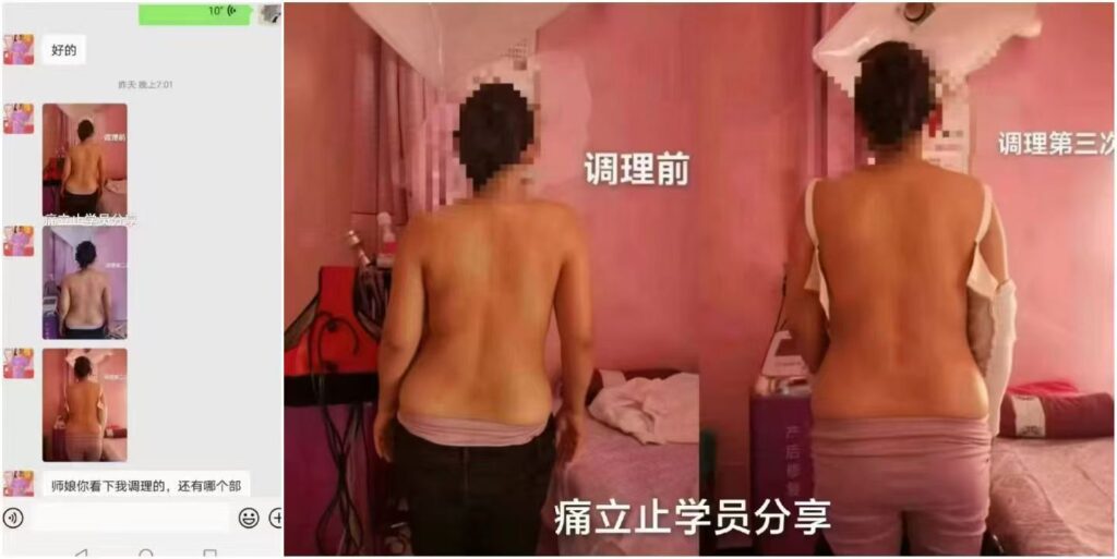 图片[15]-痛立止理骨术｜从摸骨到复位，零基础轻松掌握柔性正骨核心技术