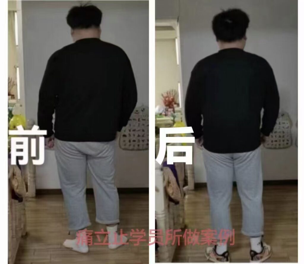 图片[17]-痛立止理骨术｜从摸骨到复位，零基础轻松掌握柔性正骨核心技术