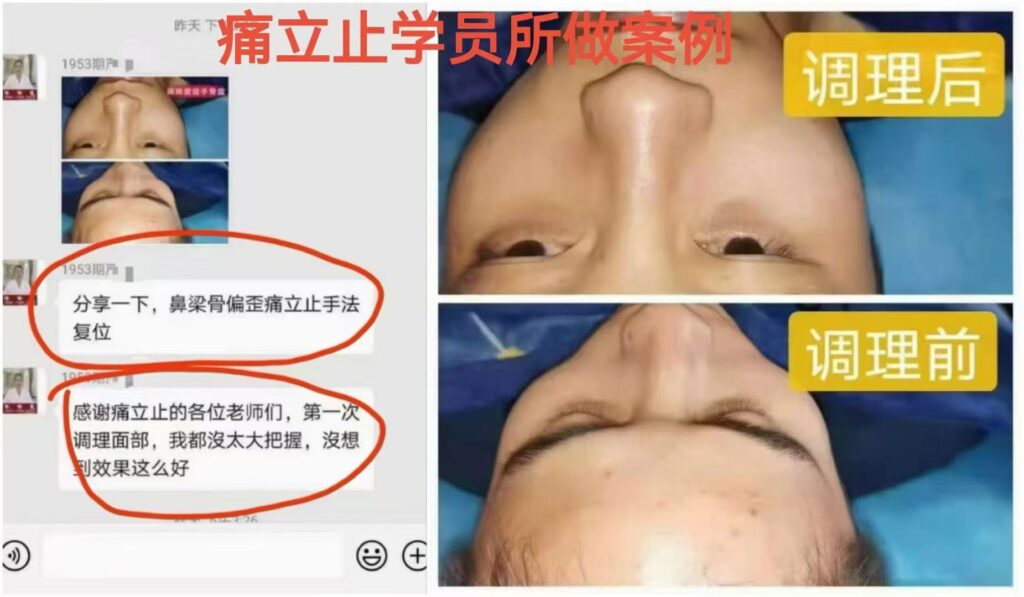 图片[19]-痛立止理骨术｜从摸骨到复位，零基础轻松掌握柔性正骨核心技术